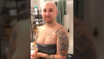 Surprising-My-Girlfriend-with-the-Bald-Head-Filter-Can-She.jpg