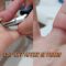 18-Year Ring Lockdown: Watch This Wild Escape from a Swollen Finger! | Most Viral Today