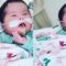Baby With Down Syndrome Bonds With Family Via Video | Super Cute