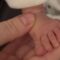 Rare Newborn with Finger-Like Toes | Super Cute